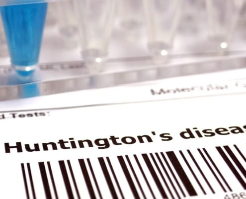 Huntington-Krankheit-Datei mit Barcode