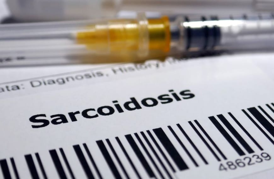 Syringe and doctors report about sarcoidosis