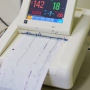 Machine Ecography effectuant un test VRC